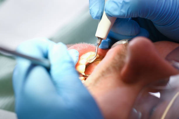 Best Knocked-Out Tooth Emergency  in Decatur, TN