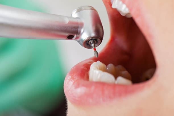 Best Dentist for Dental Trauma  in Decatur, TN